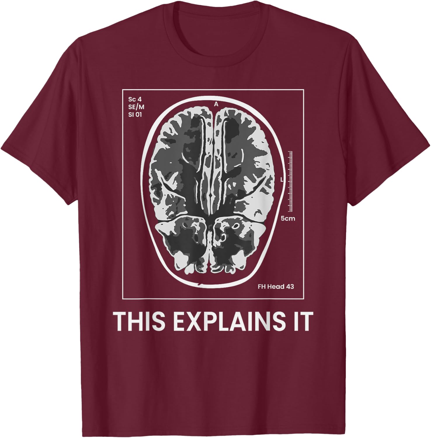 Funny MRI Scan Brain for CRAZY CAT LADY This Explains it T-Shirt - T-Shirt | Maroon