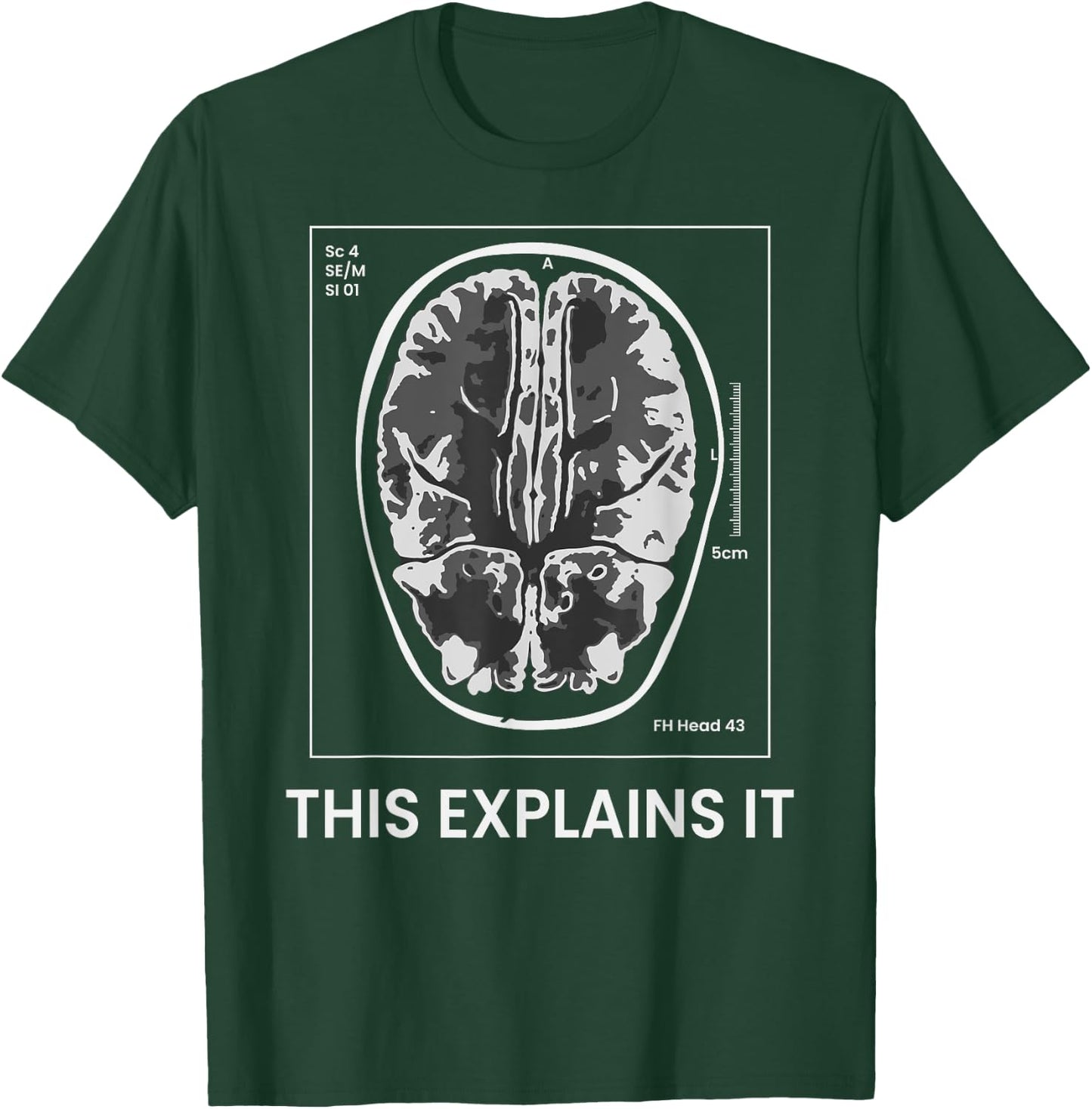 Funny MRI Scan Brain for CRAZY CAT LADY This Explains it T-Shirt - T-Shirt | Forest