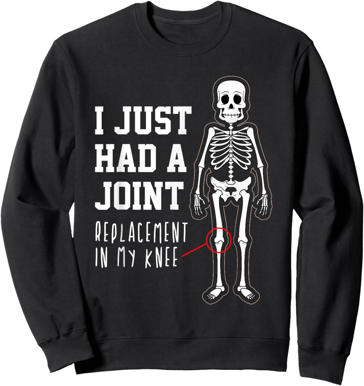 Funny Joint Replacement Knee Surgery Recovery Get Well Gift Sweatshirt - Sweatshirt | Black