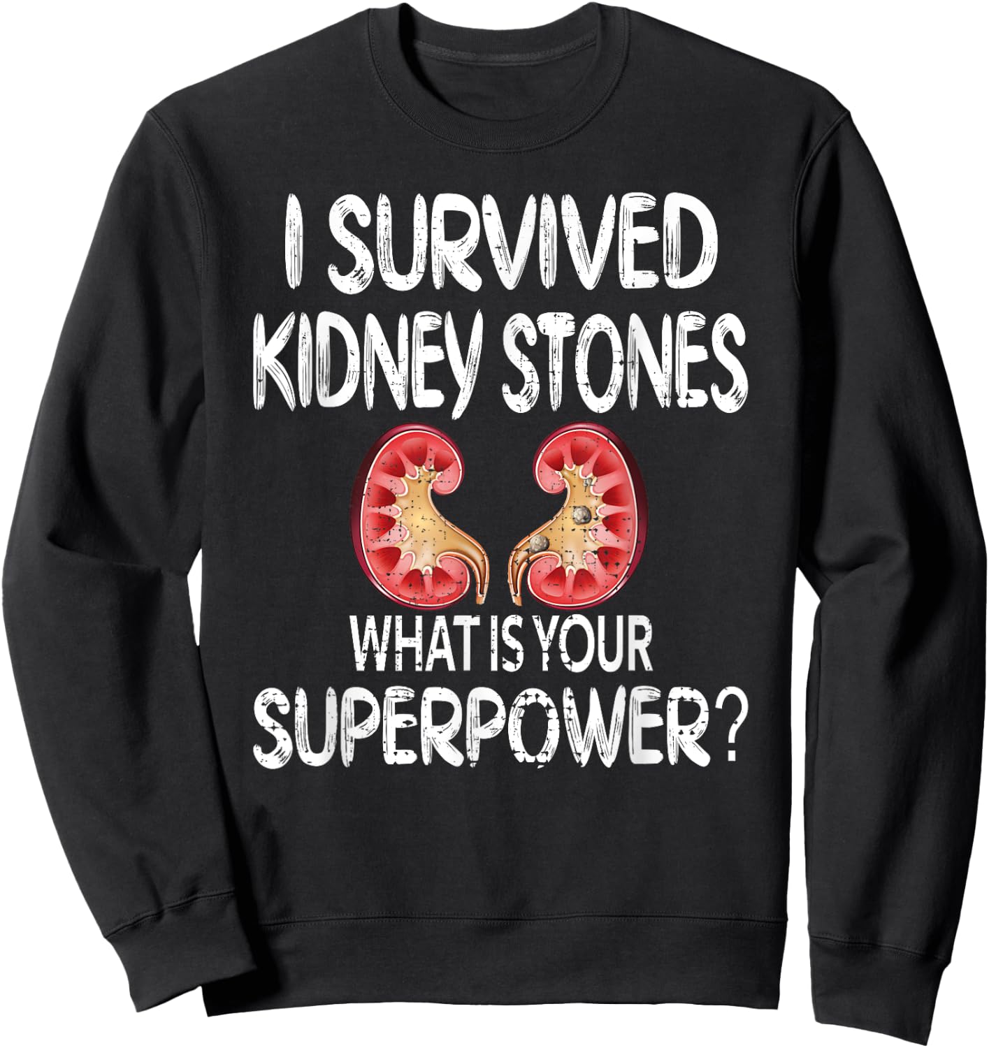 I Survived Kidney Stones Kidney Stone Recovery Sweatshirt - Sweatshirt | Black