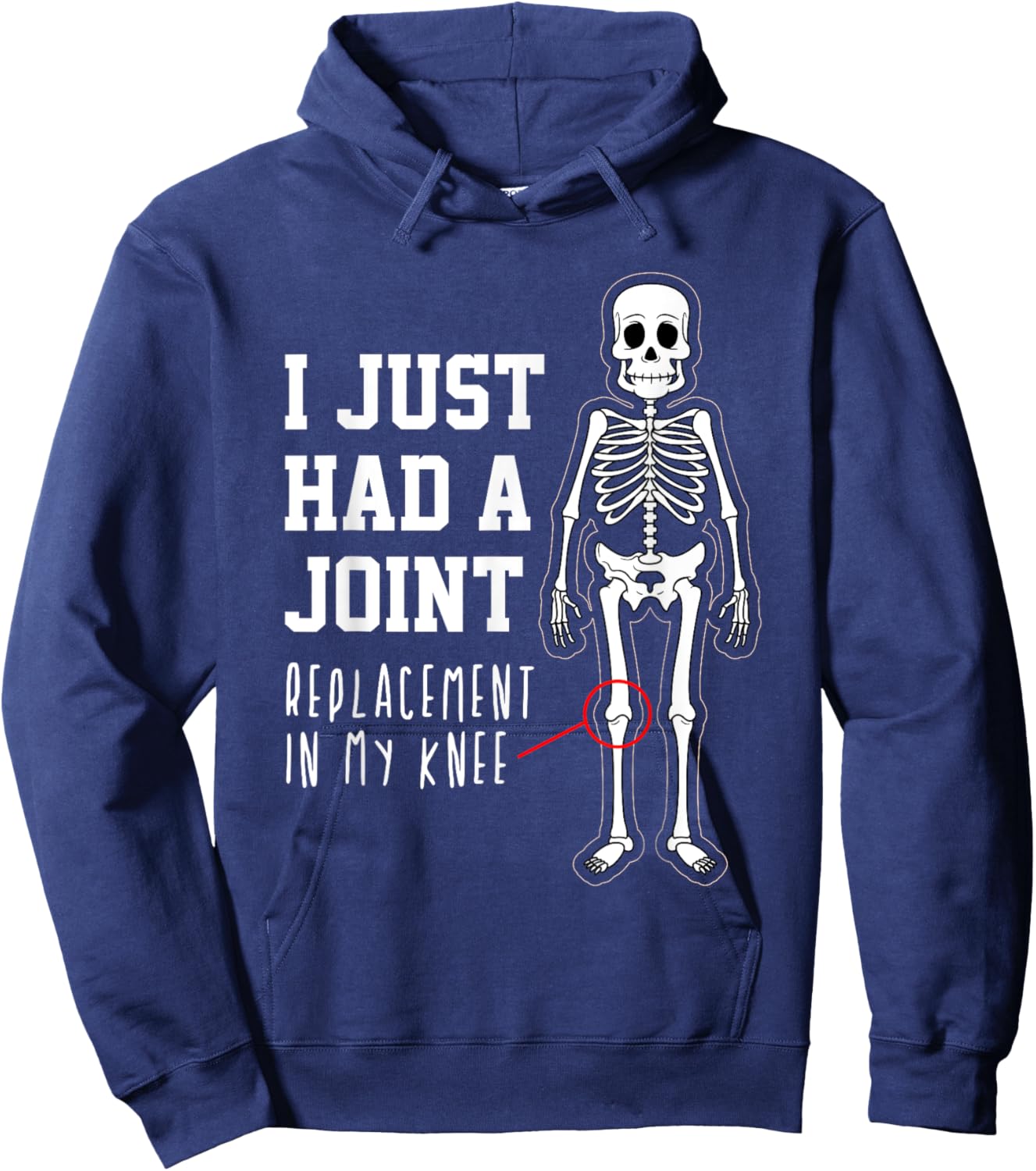 Funny Joint Replacement Knee Surgery Recovery Get Well Gift Hoodie - Hoodie | Navy