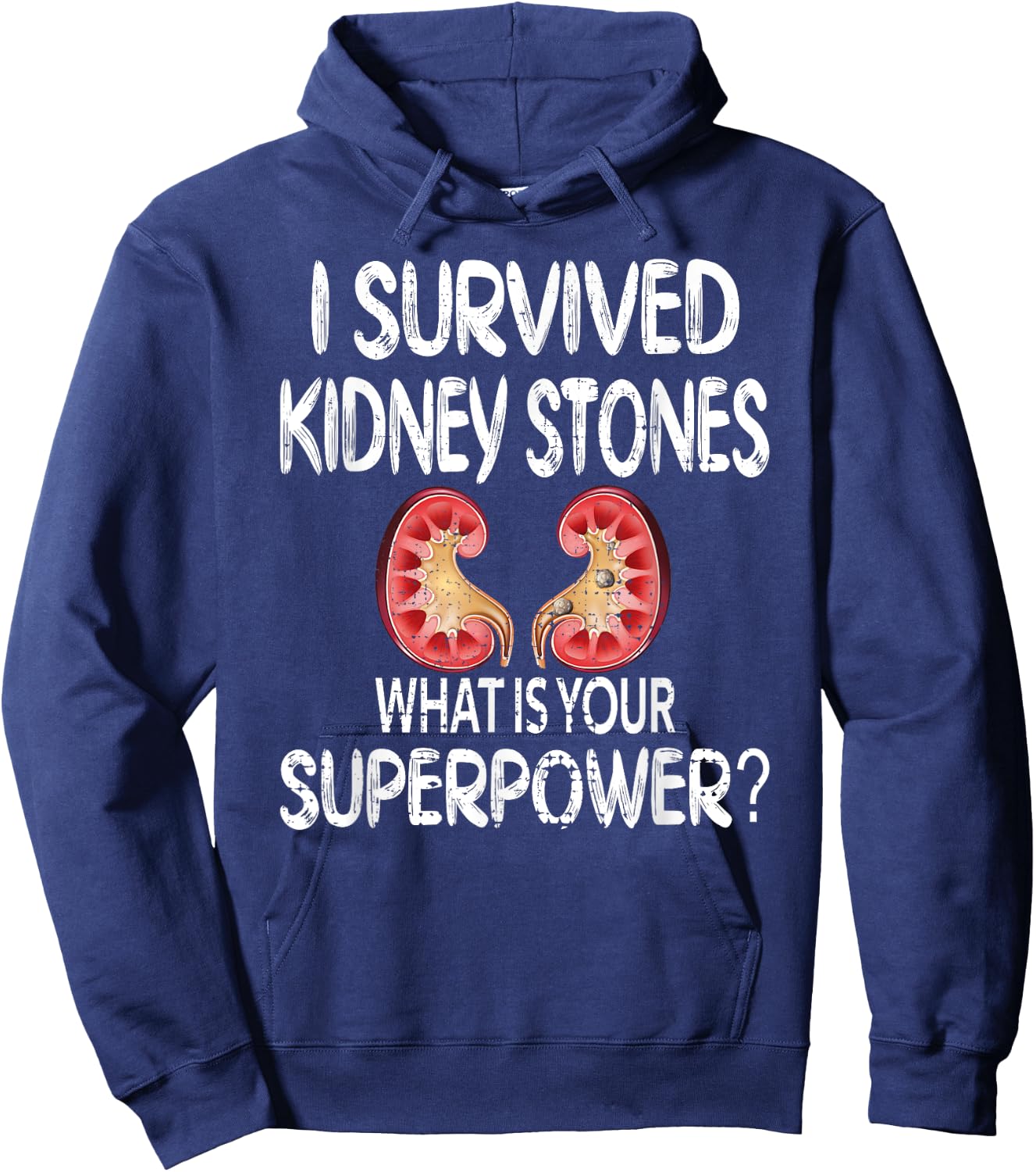I Survived Kidney Stones Kidney Stone Recovery Hoodie - Hoodie | Navy