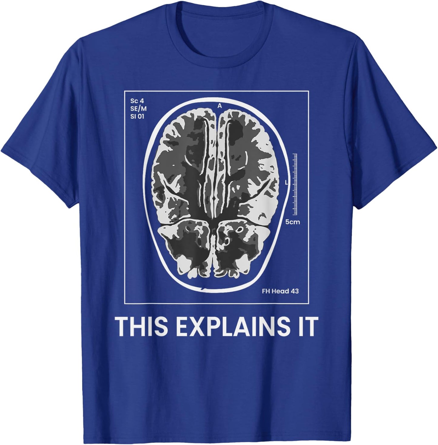 Funny MRI Scan Brain for CRAZY CAT LADY This Explains it T-Shirt - T-Shirt | Royal