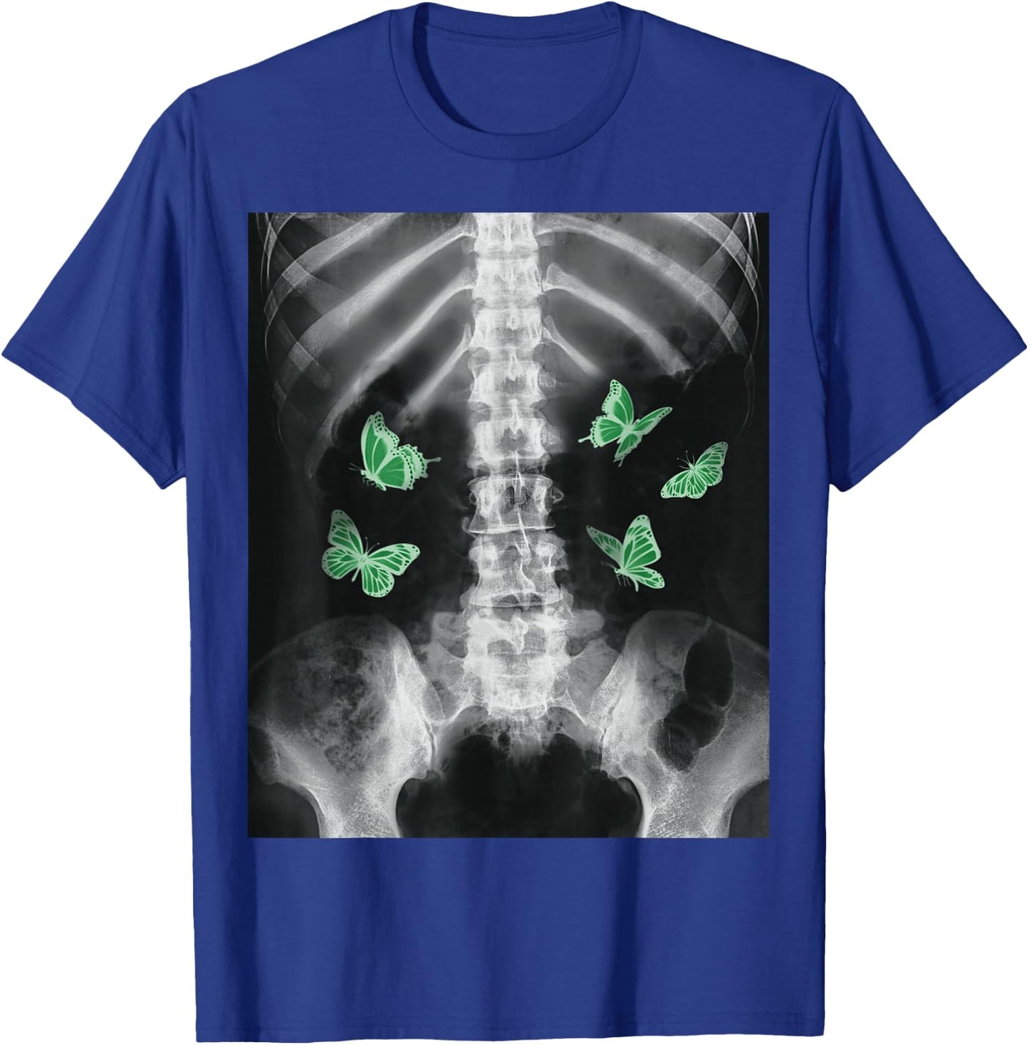 Egirl Xray Skeleton Green Butterfly Harajuku Dark Grunge Alt T-Shirt - T-Shirt | Royal