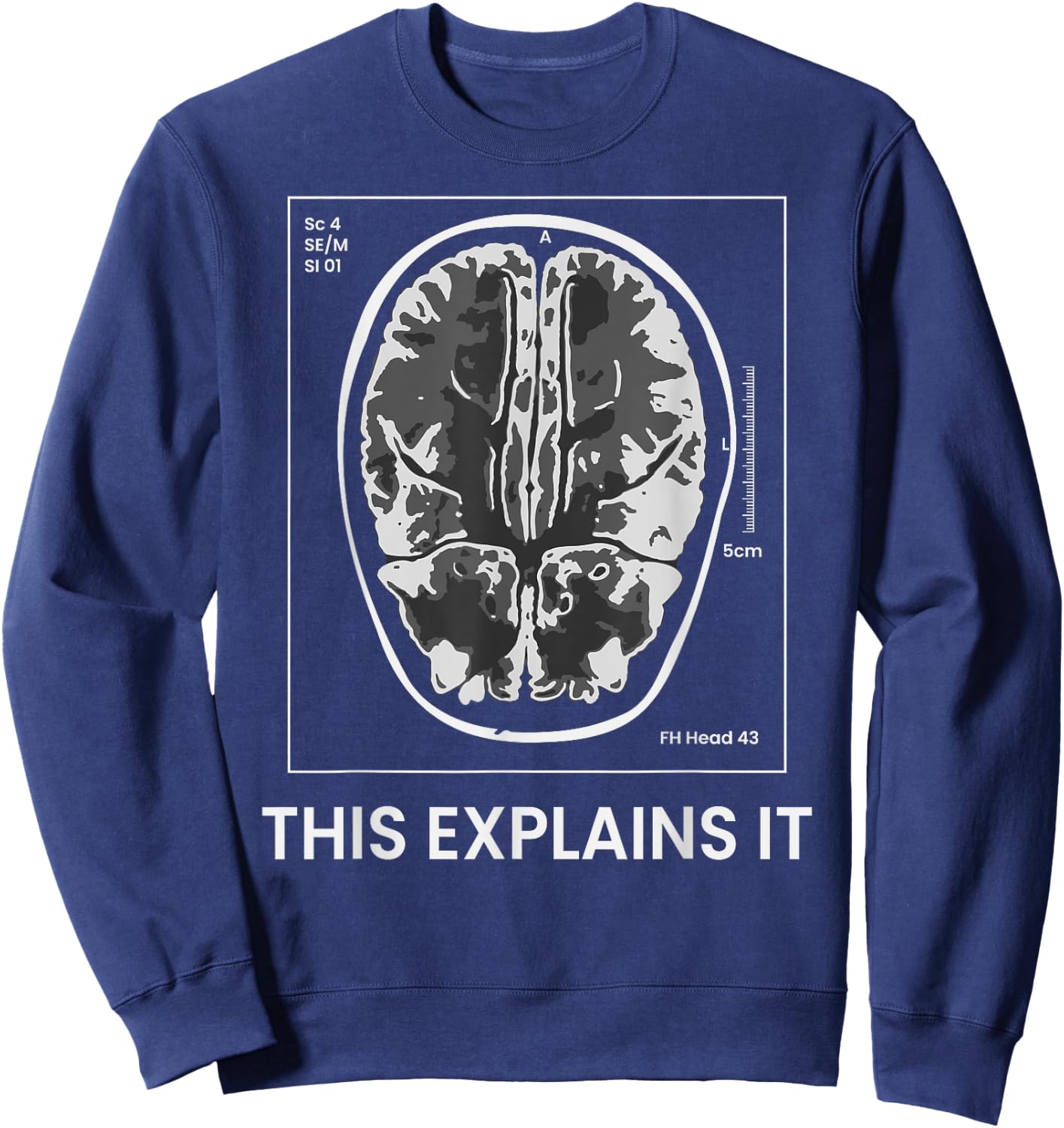 Funny MRI Scan Brain for CRAZY CAT LADY This Explains it Sweatshirt - Sweatshirt | Navy