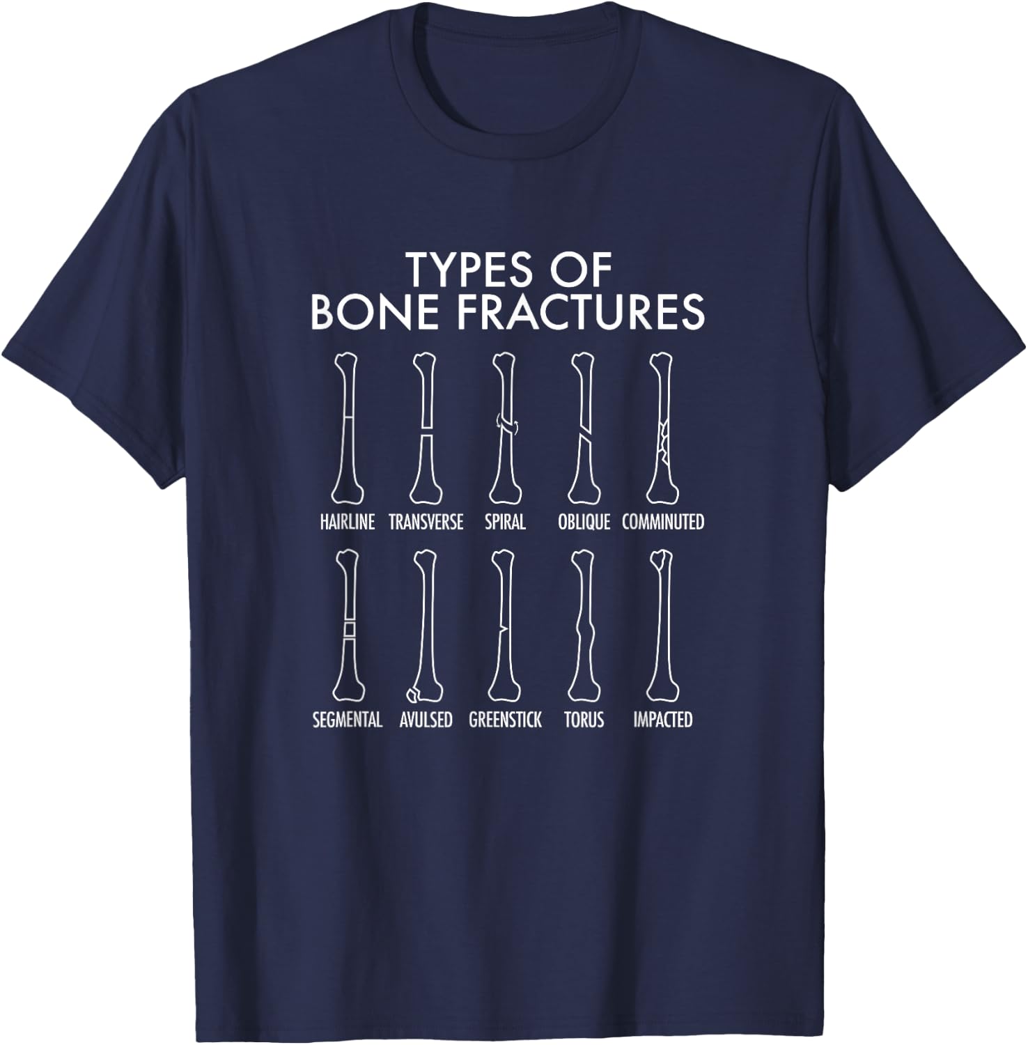 Types Of Bone Fractures, Orthopedic Surgeon T-Shirt - T-Shirt | Navy