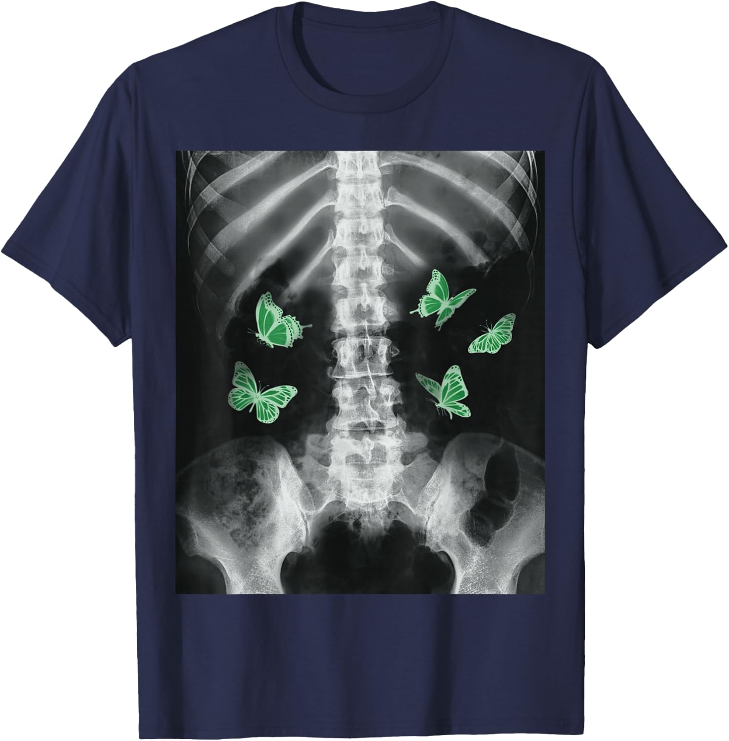 Egirl Xray Skeleton Green Butterfly Harajuku Dark Grunge Alt T-Shirt - T-Shirt | Navy