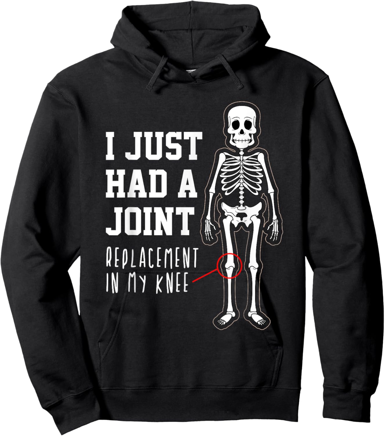 Funny Joint Replacement Knee Surgery Recovery Get Well Gift Hoodie - Hoodie | Black