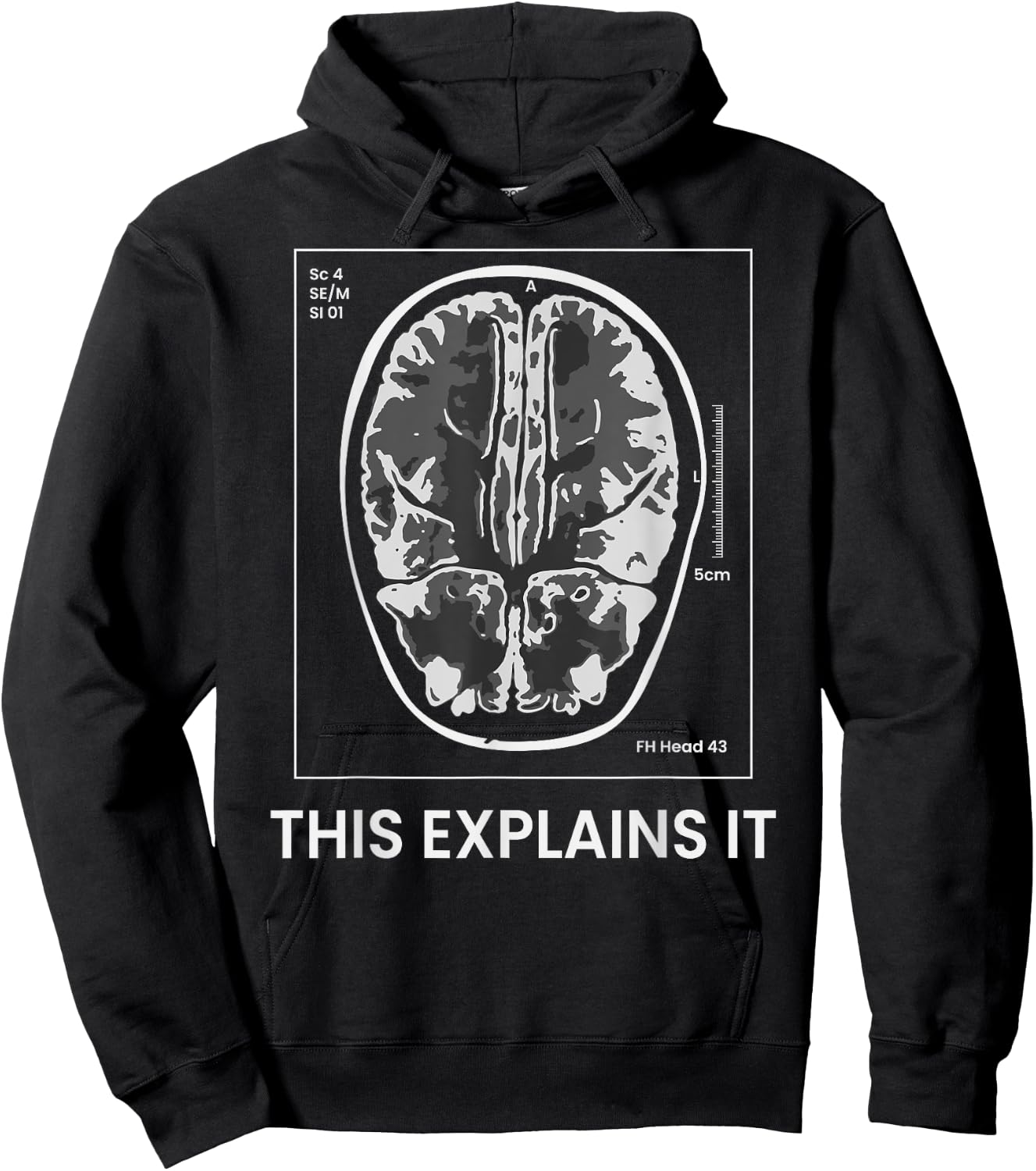 Funny MRI Scan Brain for CRAZY CAT LADY This Explains it Hoodie - Hoodie | Black
