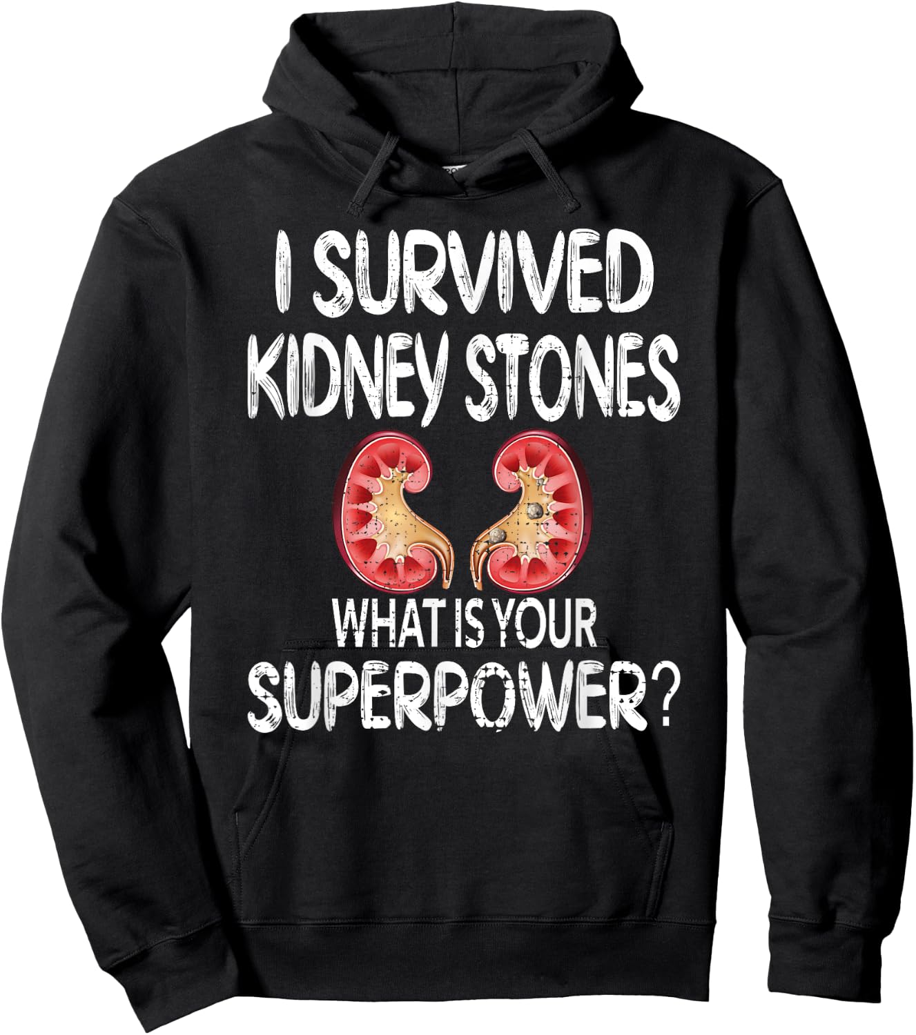 I Survived Kidney Stones Kidney Stone Recovery Hoodie - Hoodie | Black