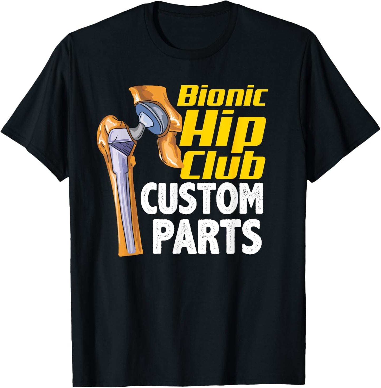 Bionic Hip Club Custom Parts Funny Hip Replacement Surgery T-Shirt - T-Shirt | Black