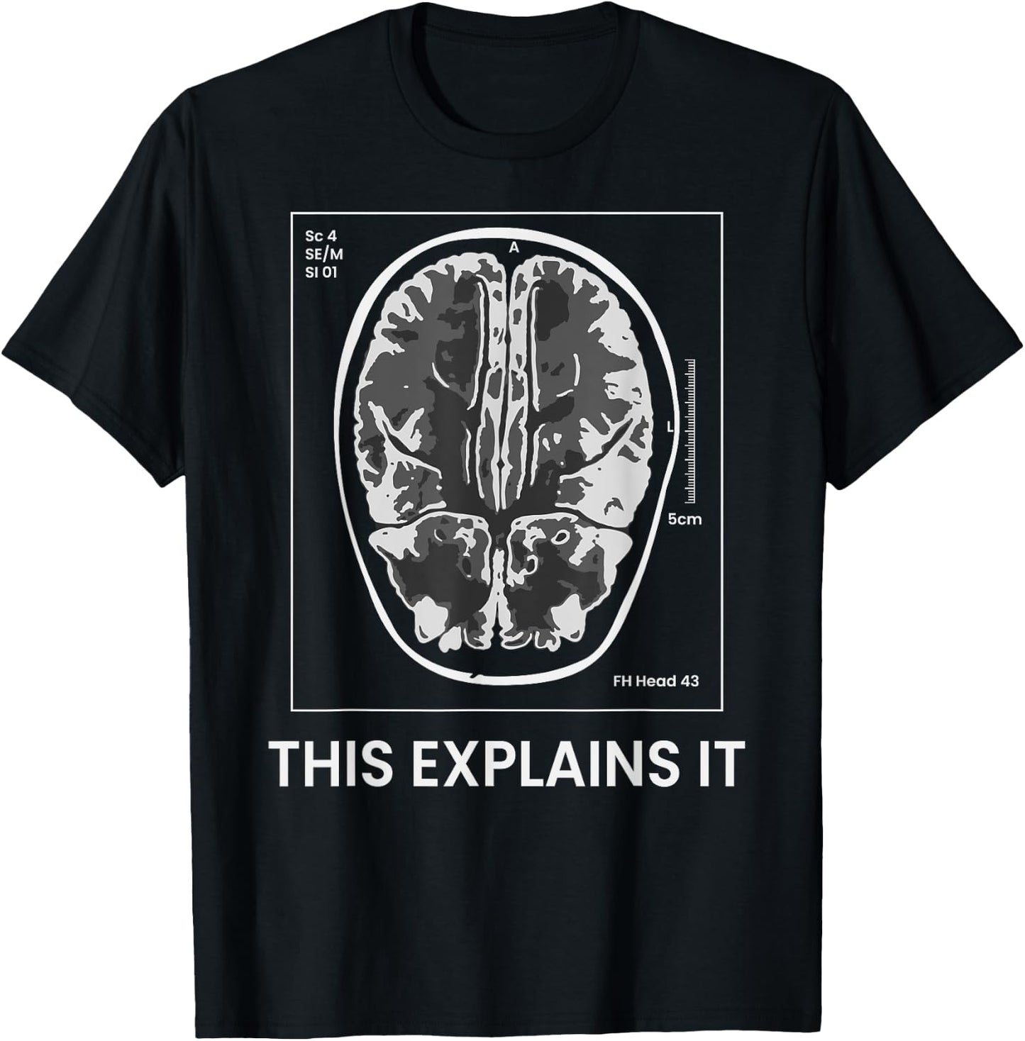Funny MRI Scan Brain for CRAZY CAT LADY This Explains it T-Shirt - T-Shirt | Black