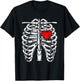 Rib Cage - Heart - Skeleton - Anatomy - X-Ray - Halloween T-Shirt - T-Shirt | Black